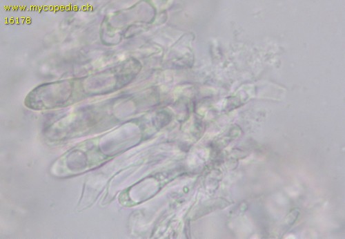 Marasmius bulliardii f. bulliardii - Cheilozystiden - Wasser  - 