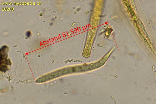 Hilberina caudata - Sporen - Melzers  - 