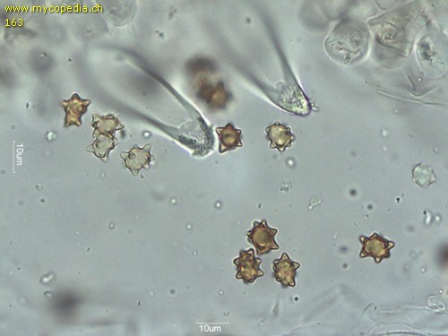 Inocybe asterospora - Cheilozystiden mit Kristallschopf - 