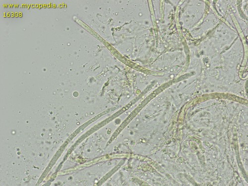 Pythium insidiosum - 