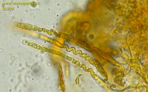 Pythium insidiosum - Asci - Baral  - 