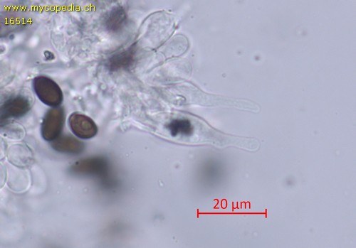 Psathyrella microrhiza - Cheilozystiden - Wasser  - 