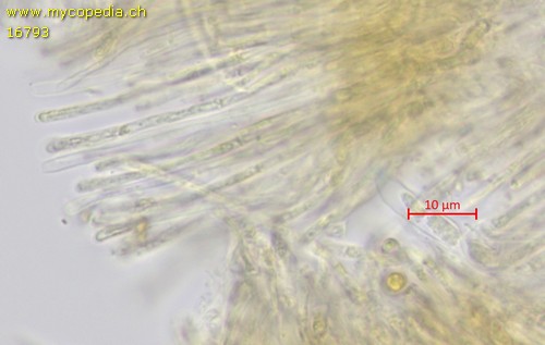 Mollisia - Paraphysen - 