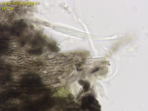 Mollisia - Excipulum - 