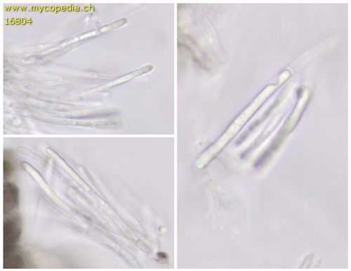 Mollisia - Paraphysen - 