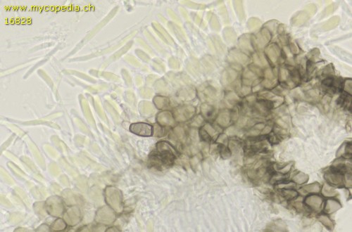 Mollisia cinerea - Excipulum - KOH  - 