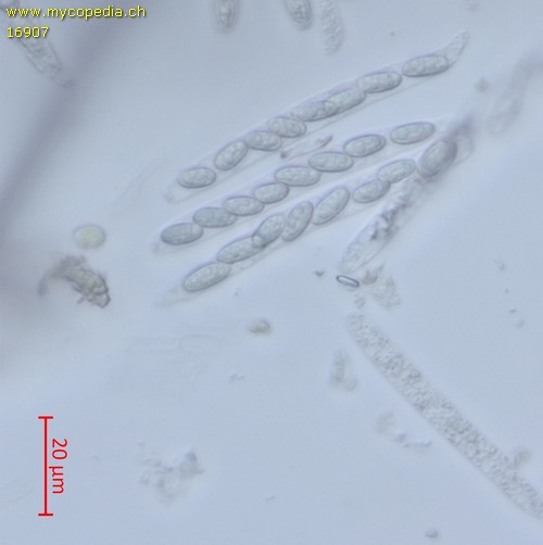 Phomatospora berkeleyi - 