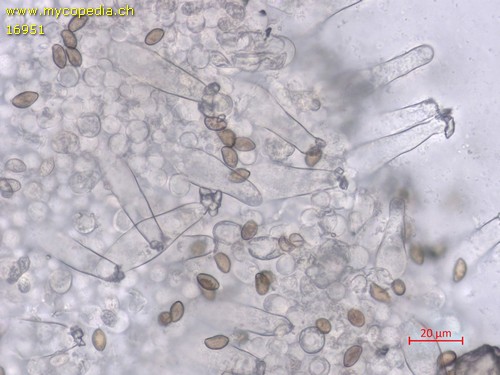 Inocybe griseolilacina - Cheilozystiden - Wasser  - 