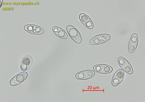 Sepultariella semiimmersa - Spore/n - Wasser  - 
