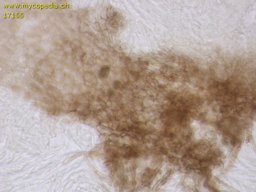 Mollisia spp - Excipulum - 