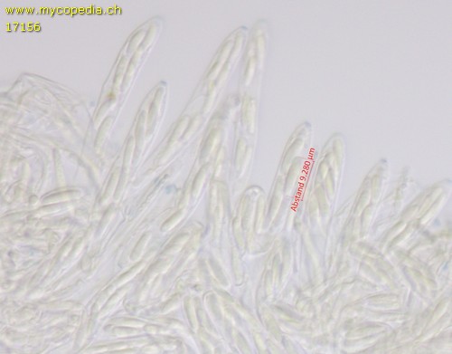 Mollisia spp - Asci - Melzers  - 