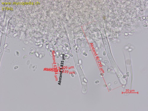 Lagarobasidium detriticum - 