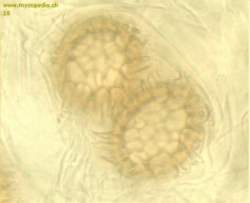 Tuber pseudoexcavatum - Ascus/Asci mit Sporen - 