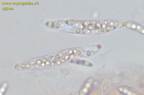 Diaporthe strumella - Asci - Kongorot  - 