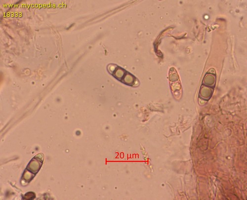 Ascotaiwania limnetica - 