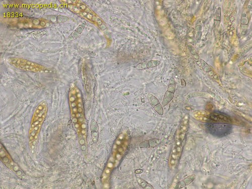 Naetrocymba nitens - Sporen & Asci - Baral  - 
