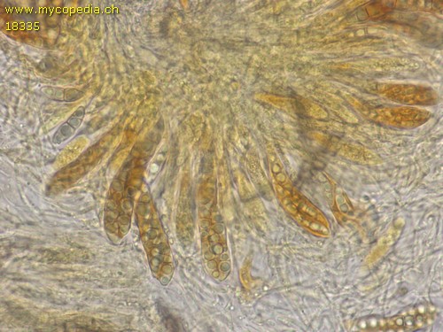 Naetrocymba nitens - Sporen & Asci - Baral  - 