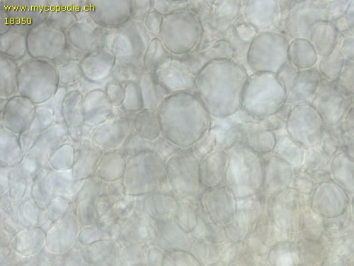 Mollisia lividofusca - Excipulum - 