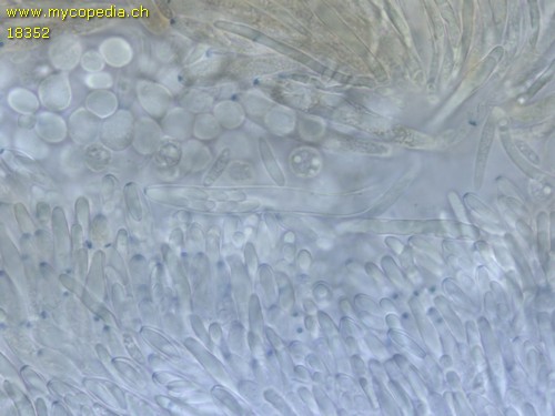 Mollisia lividofusca - Asci - Baral  - 