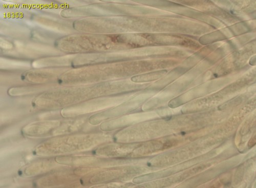 Mollisia lividofusca - Asci - Baral  - 