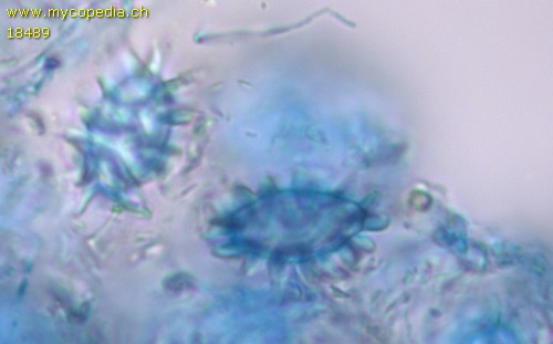 Stephanospora caroticolor - 