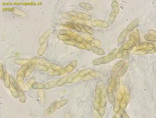 Venturia chlorospora - Sporen & Asci - Wasser  - 