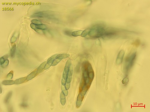 Venturia chlorospora - Sporen & Asci - Melzers  - 