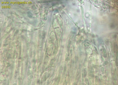 Xerombrophila crystallifera - Asci - Melzers  - 