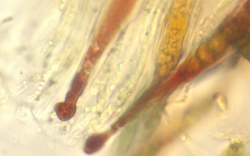 Lophiostoma triseptata - Asci - Baral  - 
