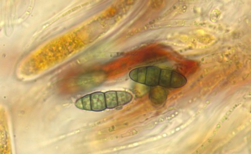 Lophiostoma triseptata - Sporen & Asci - Baral  - 