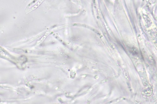 Lophiostoma triseptata - 
