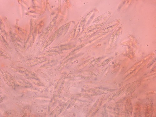 Gnomonia ostryae - Asci - Kongorot  - 