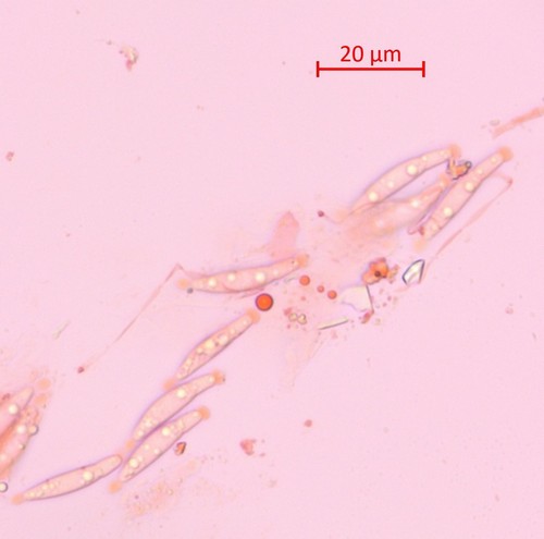 Gnomonia ostryae - Spore/n - Kongorot  - 