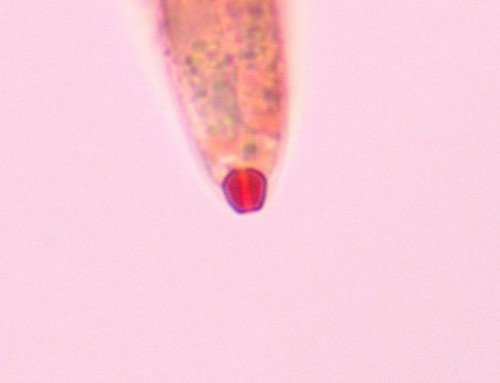Gnomonia ostryae - Apikalapparat - Kongorot  - 