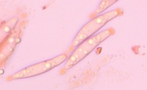 Gnomonia ostryae - Spore/n - Kongorot  - 