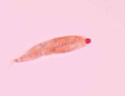 Gnomonia ostryae - Ascus - Kongorot  - 