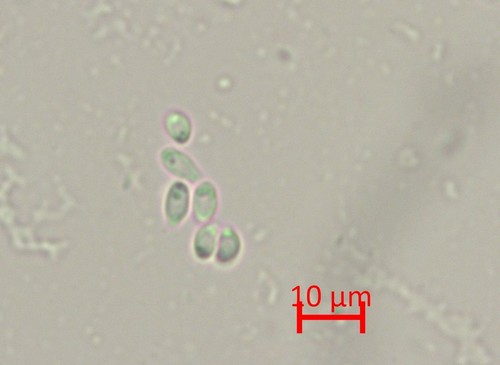 Orbilia eucalypti - Spore/n - Wasser  - 