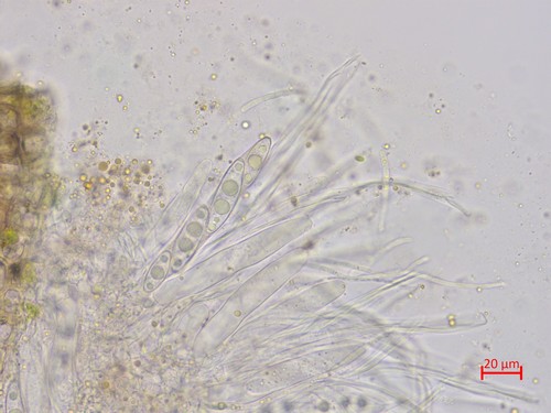 Octosporella ornithocephala - 