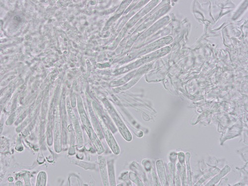 Orbilia spec. - 