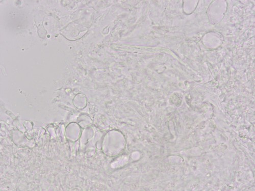 Orbilia spec. - 