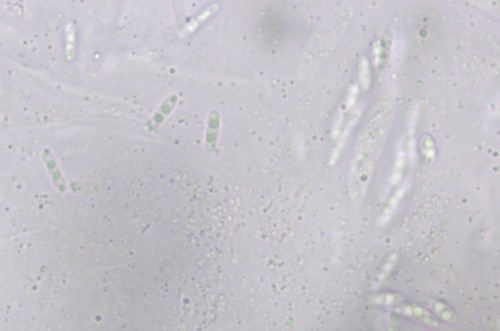 Nitschkia grevillei - 