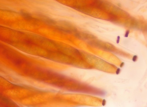 Chaetosphaeria ovoidea - 