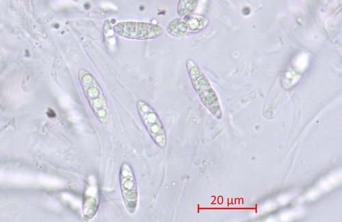 Chaetosphaeria ovoidea - 