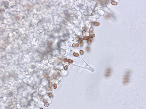 Psathyrella senex - Pleurozystiden - 