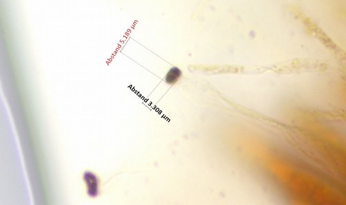 Chaetosphaeria ovoidea - 