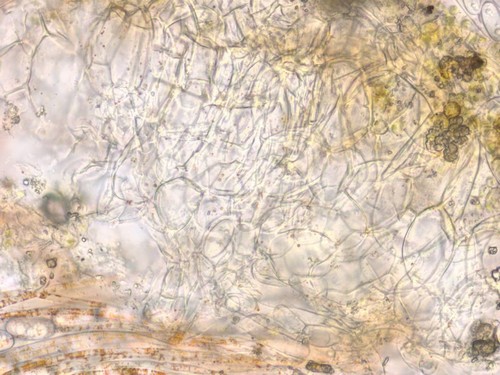 Anthracobia melaloma - Randhaare - 