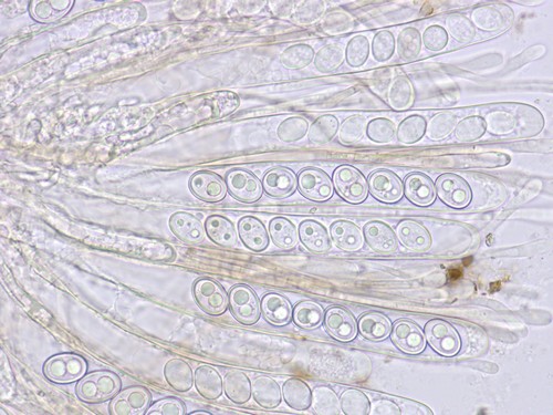 Trichophaea contradicta - Asci & Paraphysen - Wasser  - 