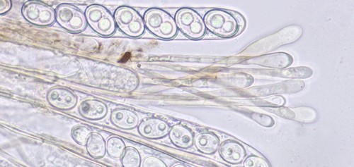 Trichophaea contradicta - Paraphysen - Wasser  - 