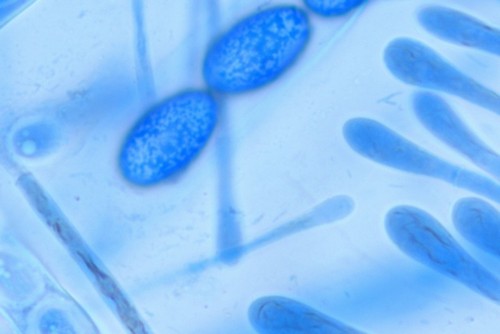 Scutellinia olivascens - 
