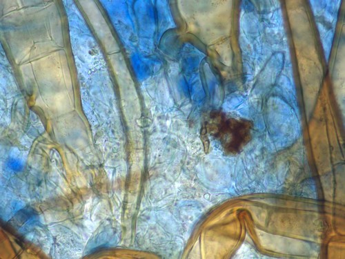 Scutellinia olivascens - Randhaare - Wiurzeln - 